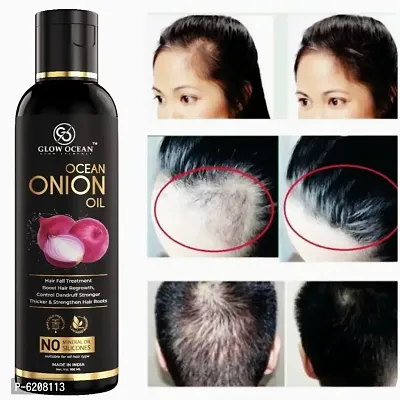 Ocean Onion oil For Hair Fall Control,Hair Growth and Hair Regrowth-Control Dandruff (100Ml)-thumb0