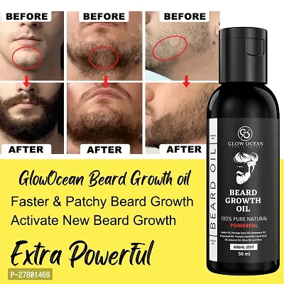 Glowocean New   Powerful Beard Growth oil-For Faster Beard Hair Growth-50 Ml-thumb0
