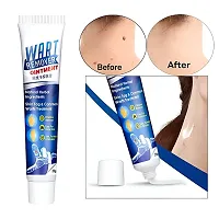 Drx 20g Warts Remover Cream Extract Skin Face Tag Extract Corn Treatment Ointment Painless For Men  Women - (Pack of 1)-thumb2