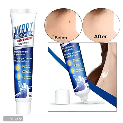 Drx 20g Warts Remover Cream Extract Skin Face Tag Extract Corn Treatment Ointment Painless For Men  Women - (Pack of 1)-thumb3