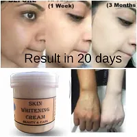 Skin Whitening Fairness Blackness Removing Face Whitening Cream 70gm Pack Of 1-thumb3