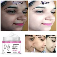 Skin Whitening Cream For Whitens Skin, Remove Melanin and Visible Fair Skin-thumb1