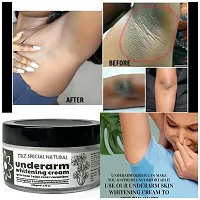 Underarm, Bikini Area, Neck, Hip, Thigh, Elbow Intense Dark Spot Removal Cream-thumb2