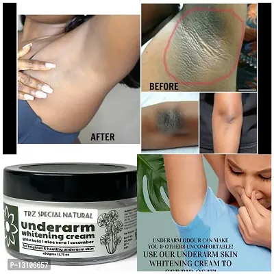 Underarm, Bikini Area, Neck, Hip, Thigh, Elbow Intense Dark Spot Removal Cream-thumb3