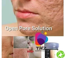 Open Pores Gel Based Cream-thumb3