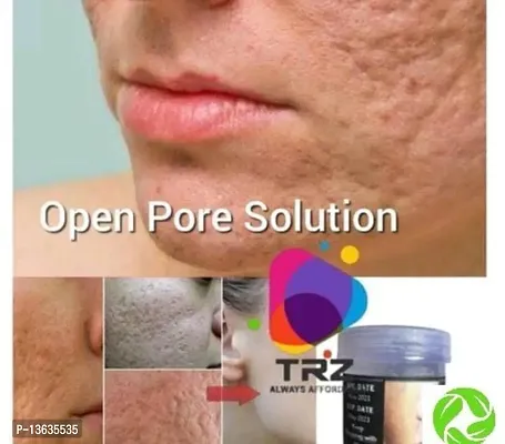 Open Pores Gel Based Cream-thumb4