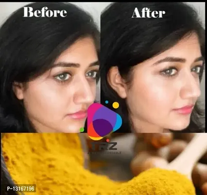 Dark Spot Corrector,Pimple Removal,pigmentation Haldi Cream