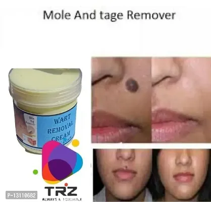 Mole Wart Remover Cream, Massa Removal Cream, For Men  Women-thumb2