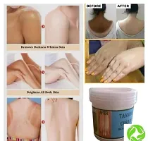 De Tan Whitening, Depigmentation  Tan Removal Cream For Neck,Body,Face-thumb1