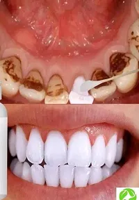 Organic Charcoal Teeth Whitening Tooth Powder-thumb1
