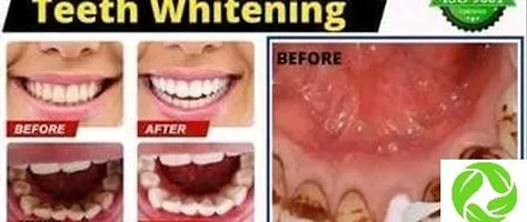Organic Charcoal Teeth Whitening Tooth Powder-thumb2