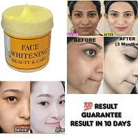 Whitening Cream For Private Parts To Remove Melanin Underarm-Elbow-Neck-Private Part Whitening Cream To Remove Melani For Men  Women (50gm) Pack of 1-thumb1