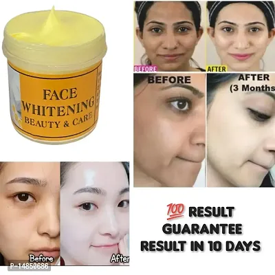Whitening Cream For Private Parts To Remove Melanin Underarm-Elbow-Neck-Private Part Whitening Cream To Remove Melani For Men  Women (50gm) Pack of 1-thumb2