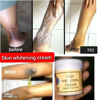 Trz Cream for Skin Whitening, Anti Ageing and Glass Skin, Enrich with Vitamin C