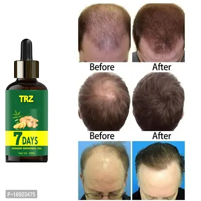 Natural Hair Loss Treatment Ginger Germinal Serum Essence Oil Hair Oil-thumb0