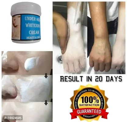 Underarm Complete Care Cream -Helps Lighten Dark Armpits | Keeps Underarm dry