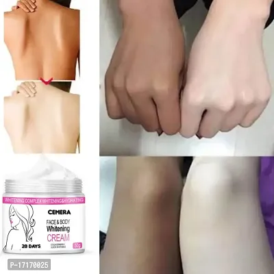 Best Skin Whitening Cream-thumb4