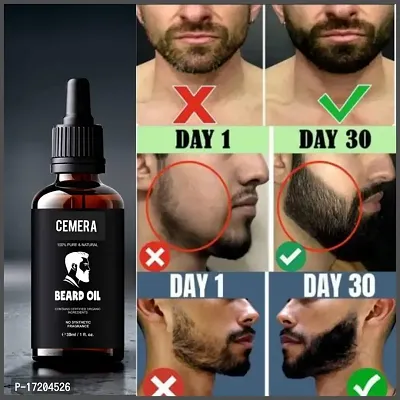 Cemera Beard  Hair Growth Oil for thicker, longer beard | For patchy, uneven beard | Beard Oil for fast beard growth | Natural Hair Oil-thumb0