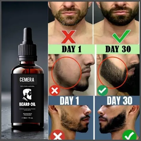 Cemera Beard  Hair Growth Oil for thicker, longer beard | For patchy, uneven beard | Beard Oil for fast beard growth | Natural Hair Oil