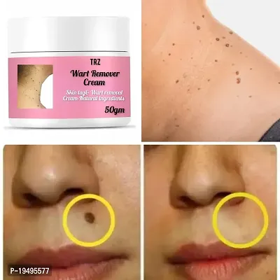 Wart Remover Cream For Face, Neck and Body-Warts Remover Cream Extract Skin Face Tag Extract Corn Treatment Painless For Men Women