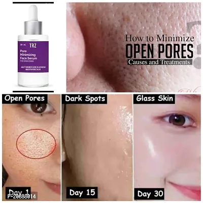 The TRZ Open Pores Serum For Pore Minimize-thumb0