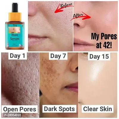 Open pore Skin toner for oily skin, bye - bye Open pores