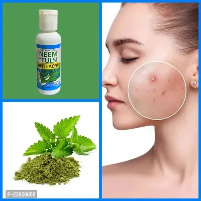 Bye Bye Pimple NeemTulsi Face Wash For Pore Tightening  REMOVE Acne,  Blackheads, face Anti Ageing AND Whitening 50ml-thumb3