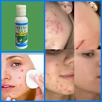 Bye Bye Pimple NeemTulsi Face Wash For Pore Tightening  REMOVE Acne,  Blackheads, face Anti Ageing AND Whitening 50ml-thumb3