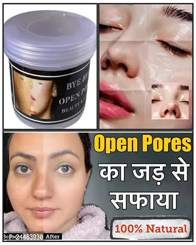 Open Pore Gel Cream | How To Close Open Pores on Face - Types, Causes, Treatment Methods-thumb0