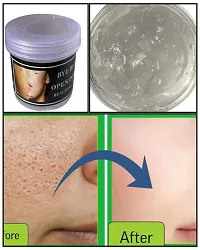 Open Pore Gel Cream | How To Close Open Pores on Face - Types, Causes, Treatment Methods-thumb2