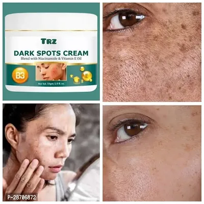 Dark Spot Cream For Dark Spot And Acne Marks-thumb0