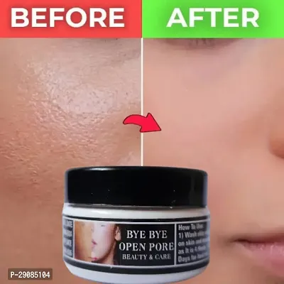 Bye Bye Open Pores Face Cream For Pore Tightening  REMOVE Acne, Blackheads And Give Instant Glow