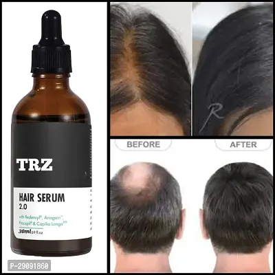 TRZ Hair Serum For Hair Fall Control And Hair Growth