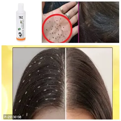 Ayurvadic Anti Lice Shampoo Lice treatment 100% Natural Shampoo