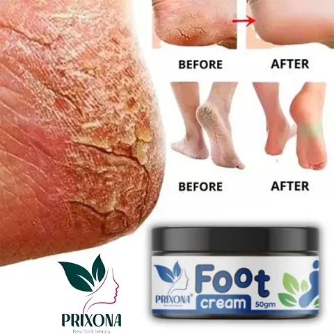 PRIXONA Crack Blaster Repair - Cracked Skin, Heel, Finger Healing Balm and Crack Blaster Dry Skin and Body Cream (50gm)