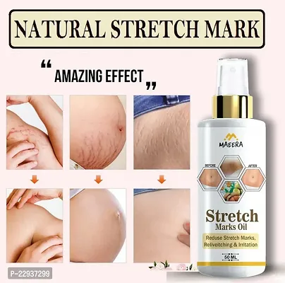 Stretch Marks Oil |For Stretch Marks Removal, Even Toned Skin |With Goodness Natural Oil-Pack Of 2 50Ml-thumb5