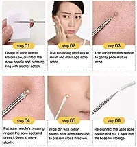 Elecsera Blackhead Comedone Acne Blemish Remover Stainless Needles Remove Tool Kit (Silver) - (Pack of 4)-thumb1