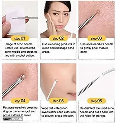 Elecsera Blackhead Comedone Acne Blemish Remover Stainless Needles Remove Tool Kit (Silver) - (Pack of 4)-thumb2