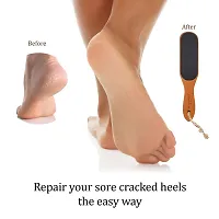 Elecsera Foot Scrubber For Dead Skin Remover For Women And Men, Pack Of 1 Pcs-thumb2