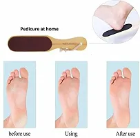 Elecsera Foot Scrubber Pedicure File Foot Filer for Dead Skin Professional Pack of 1-thumb1