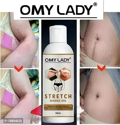 OMY LADY present Repair Stretch Marks Removal - Natural Heal Pregnancy Breast, Hip, Legs, Mark oil 50 ml pack of 1-thumb0