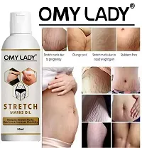 OMY LADY present Repair Stretch Marks Removal - Natural Heal Pregnancy Breast, Hip, Legs, Mark oil 50 ml pack of 1-thumb1