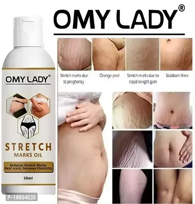 OMY LADY present Repair Stretch Marks Removal - Natural Heal Pregnancy Breast, Hip, Legs, Mark oil 50 ml pack of 1-thumb2