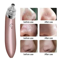 Flipco Blackhead Remover Pore Vacuum Cleaner Air Suction Machine USB With Charger Electric Pimple Extractor Skin Care ace Whitehead Remover Tool-thumb2
