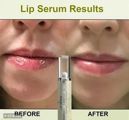 Premium Quality Roll On Lip Serum Oil For Softer And Lighter Lips | Lips Brightening Serum | Black Lips Whitening For Best Lip Serum | (Ideal For Men And Women) 10Ml Pack Of 1-thumb0