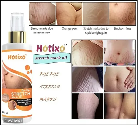 HOTIXO STRECH MARK OIL PACK OF 01