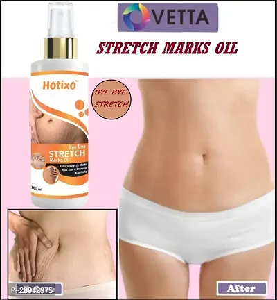 HOTIXO STRECH MARK OIL PACK OF 01