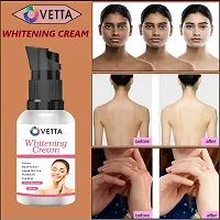 Ovetta  Whitening Cream Pack Of 01-thumb4