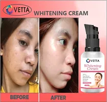 Ovetta  Whitening Cream Pack Of 01-thumb1