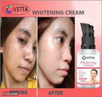 Ovetta  Whitening Cream Pack Of 01-thumb2